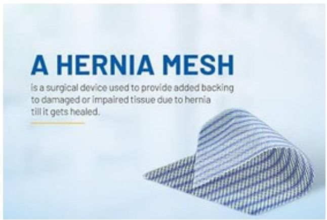 Hernia Mesh